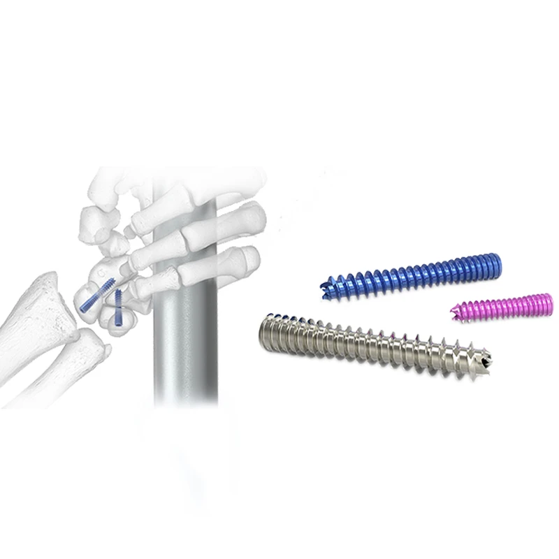 Meditech  Medical Titanium Orthopedic Implants Cannulated Herbert Screw Headless Cannulated Screw With Price