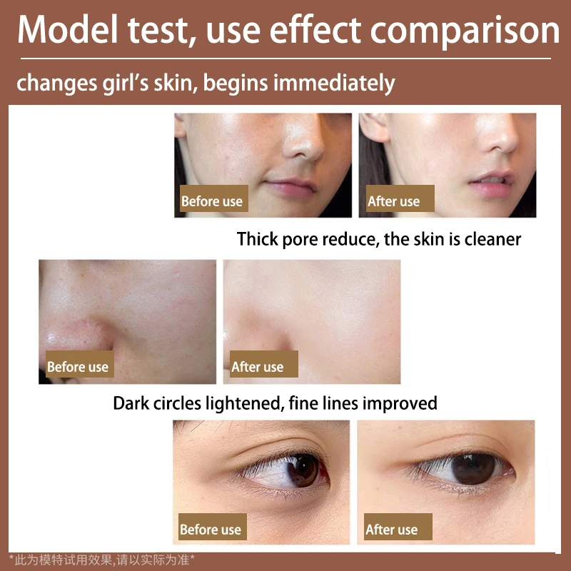 Portable led rf beauty instrument portable face radio frequency facial eye skin care home use beauty rf equipment