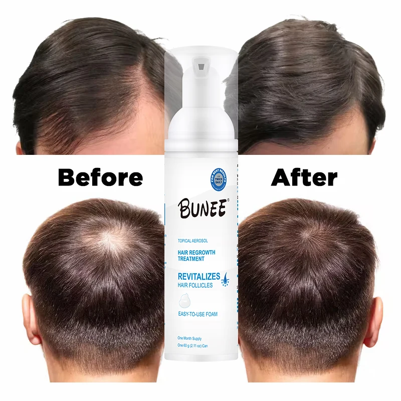 60ml reactivates hair follicles Topical solution Collagen biotin hair growth serum foam