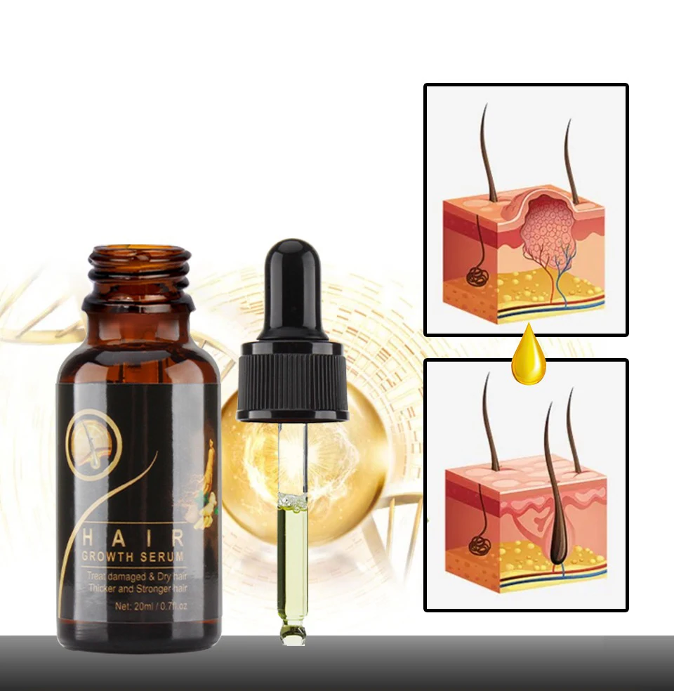 Low Moq Organic Bulk Ginger Germinal Oil Treatment Products Natural Hair Growth Oil Serum