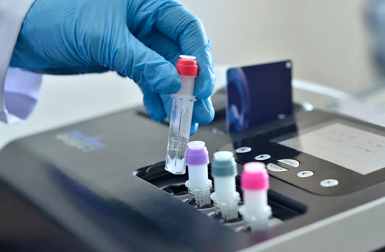 Medical diagnostic equipment Testing Top Touch screen hormones measurement Immunofluorescence Quantitative Analyzer (POCT)