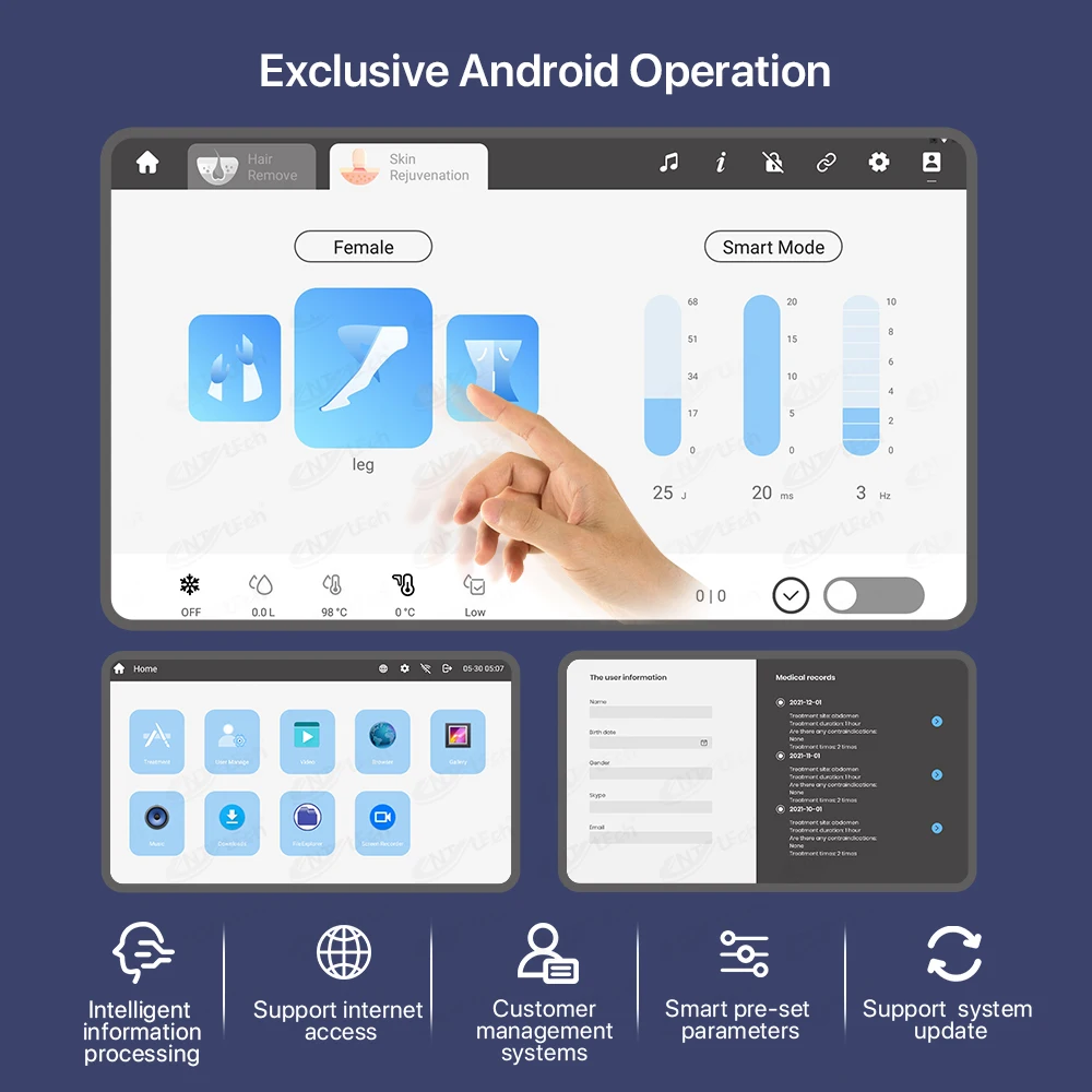 Hot selling 755nm 808nm 1064nm portable diode laser hair removal machine