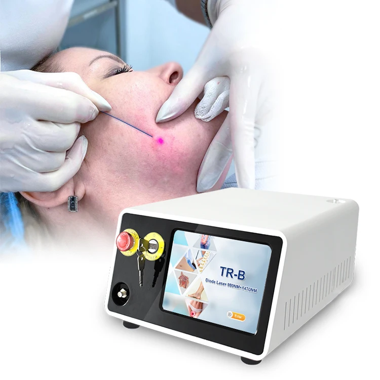 980 1470nm diode laser lipolysis machine liposuction canula endolaser machine fiber optic price