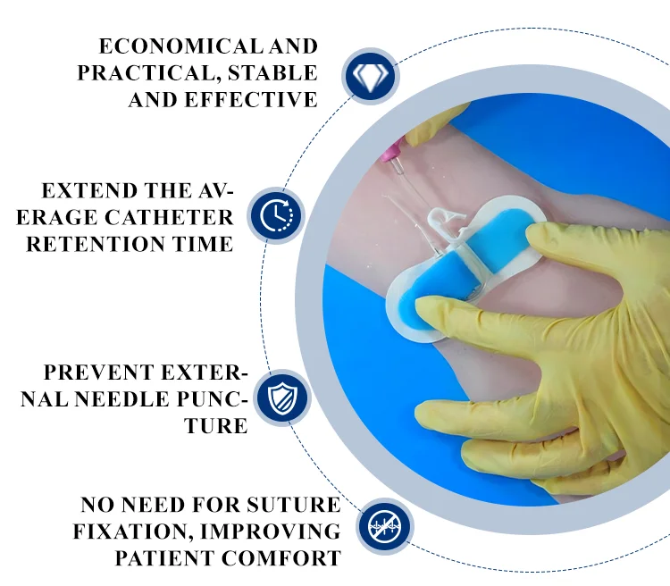 Catheter Stabilization Device PD Dialysis Patch Peg Tube J Tube G-Tube Holders Peritoneal Dialysis Accessories