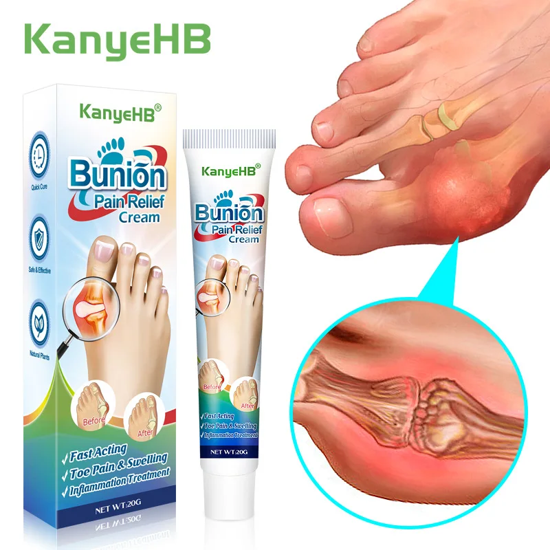KangyeHB Joint Pain Ointment Toe Valgus Pain Relieve Cream Hand Wrist Thumb Finger Rheumatism Arthritis Joint Medical Plaster