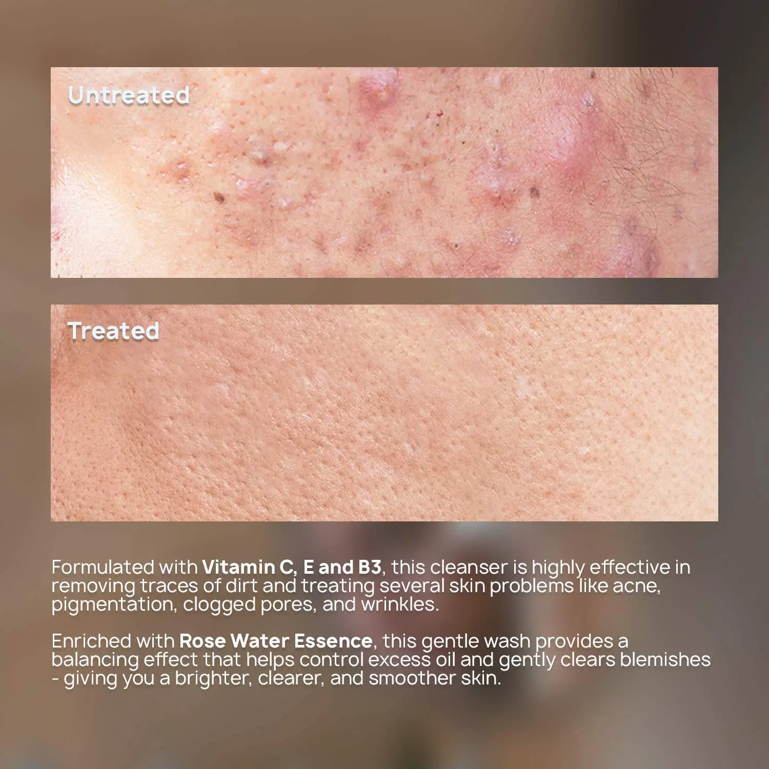 Cruelty Free Vegan Formula Paraben Free Amino Acid Facial Cleanser Face Wash Gel with Vitamin E, Honey