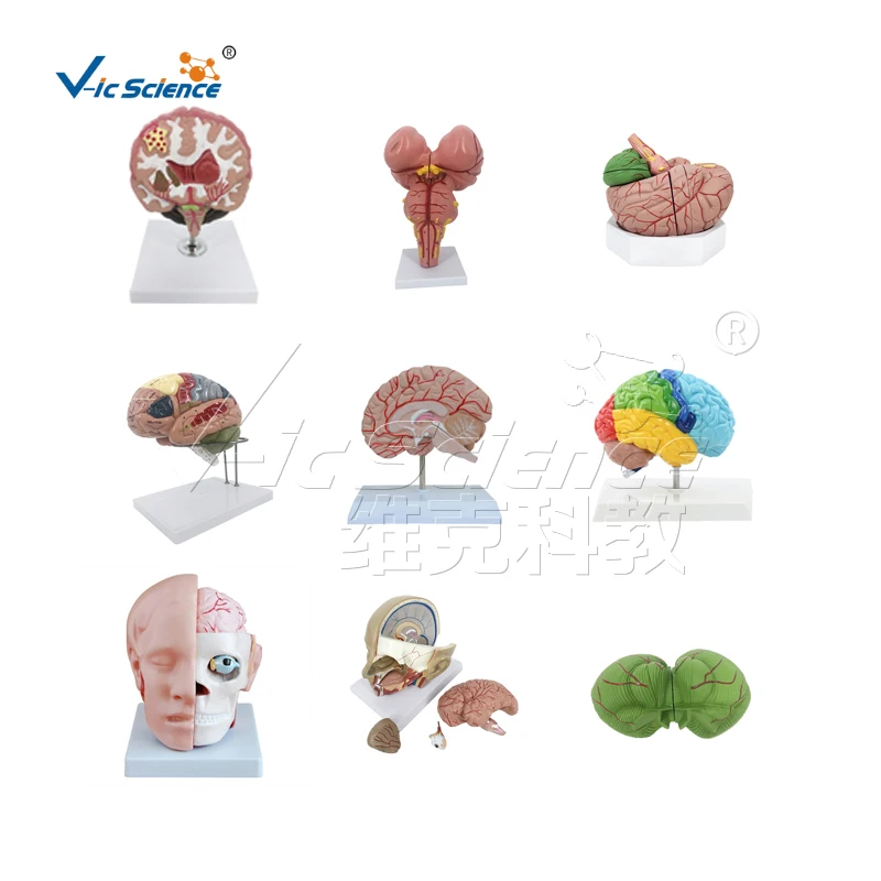 Brain with Arteries 9 Parts temporal and occipital lobes frontal and parietal lobes