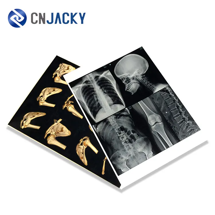 
Factory Price Hospital Use Medical Radiation Printing Film 