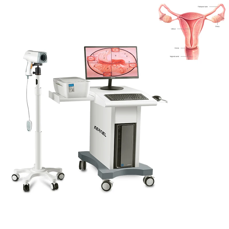 KN-2200 Video Colposcope Digital Colposcopy LED Cold Lighting System Camera with CE ISO