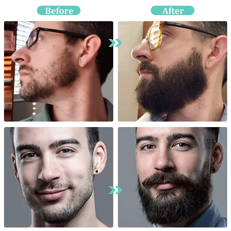 private label best regrowth growth oil organic custom new male care beard growth Kit for men grooming care