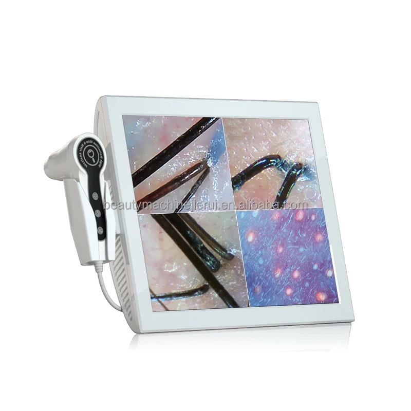 4 lens laptop type skin analyzer and hair scalp follicle enlarge analysis machine with two camera