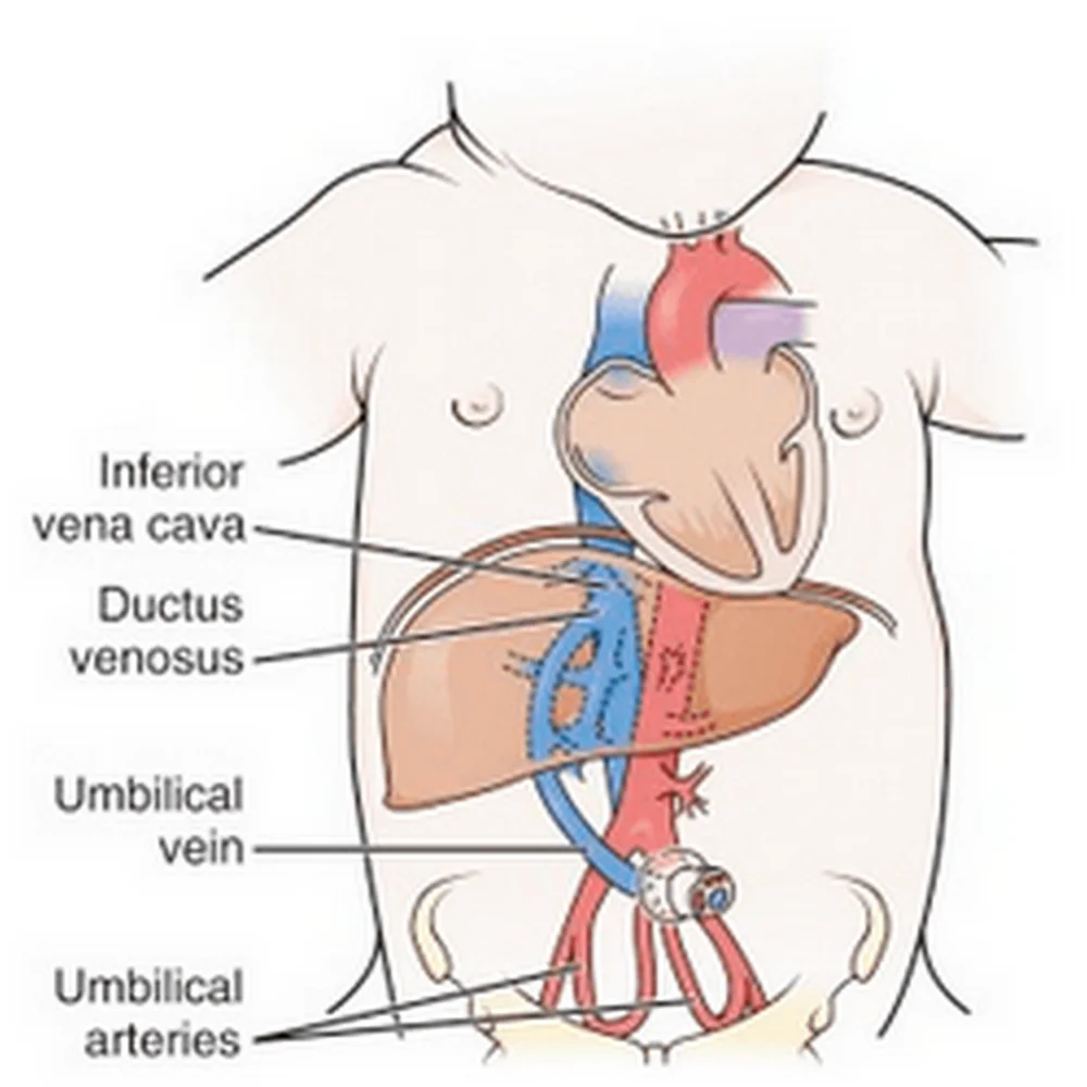 Polyurethane Medical Tubing for Umbilical Catheter 3fr Single Lumen