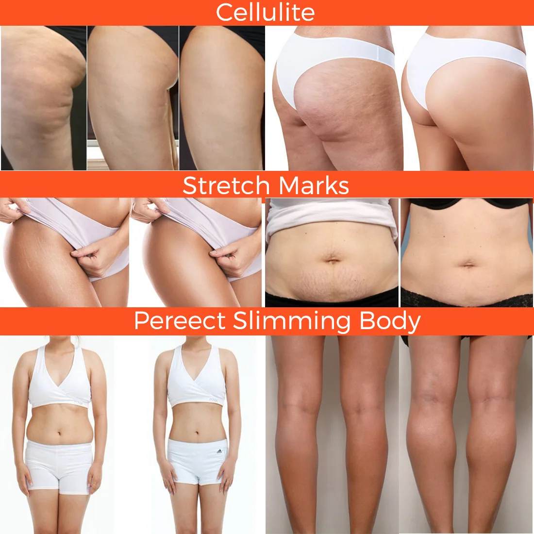 Custom Logo Body Weight Loss Arm Slimming Cream Gel Stretch Mark Burns Fat Anti Cellulite Cream for Tummy Waist Thigh Hips