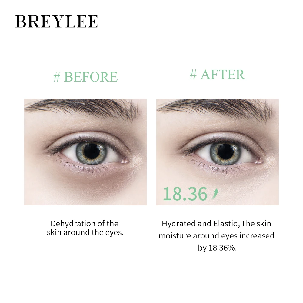 BREYLEE high quality aloe vera  eye skin care brithening repairing eye mask gel patch moisturizing repairing eye mask