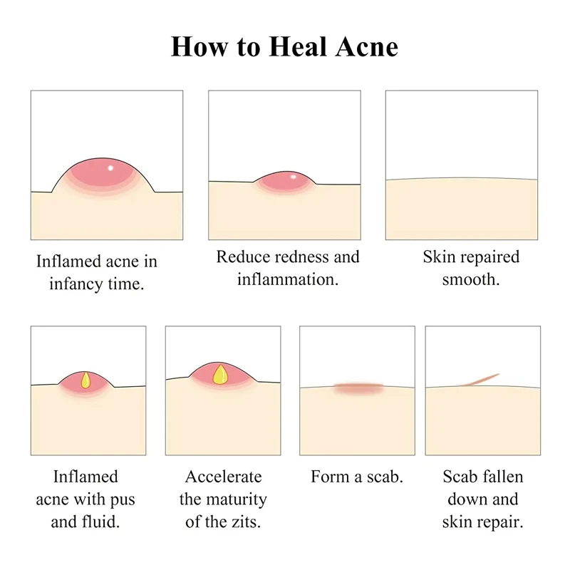 Private Label OEM  moisturizing Dark Spot Remover whitening anti aging removal salicylic acid Acne  turmeric face serum