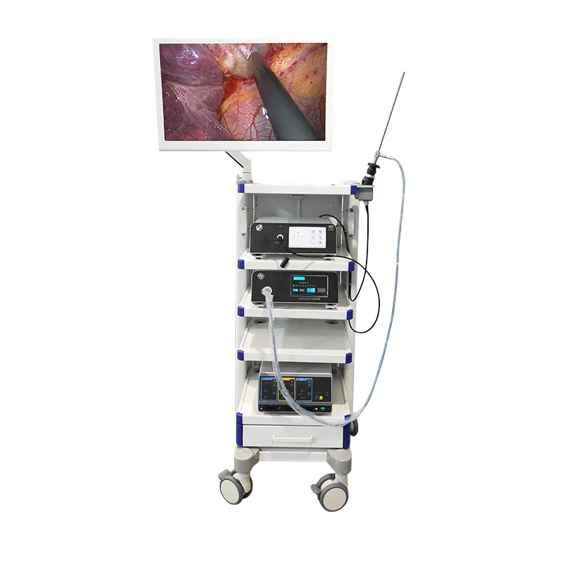 Медицинская система эндоскопа гистероскопии набор гинекологии для гинекологической диагностики