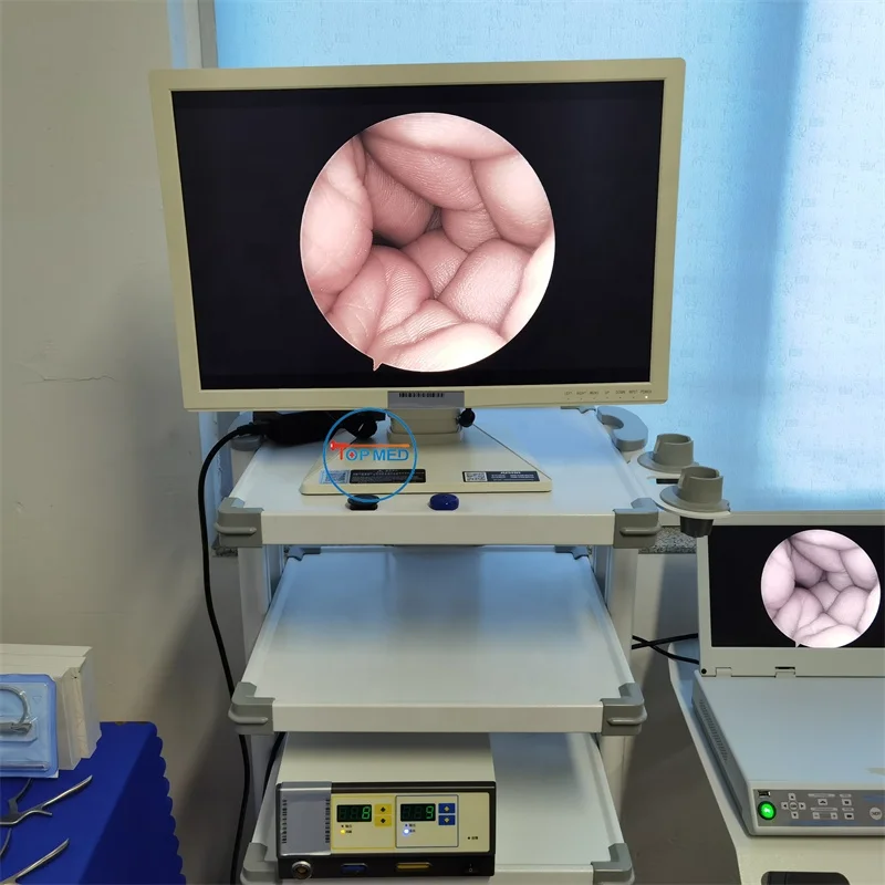 FHD Endoscopy Camera HD Unit Portable endoscope camera system for Laparoscopy Hysteroscopy Urology ENT Arthroscopy