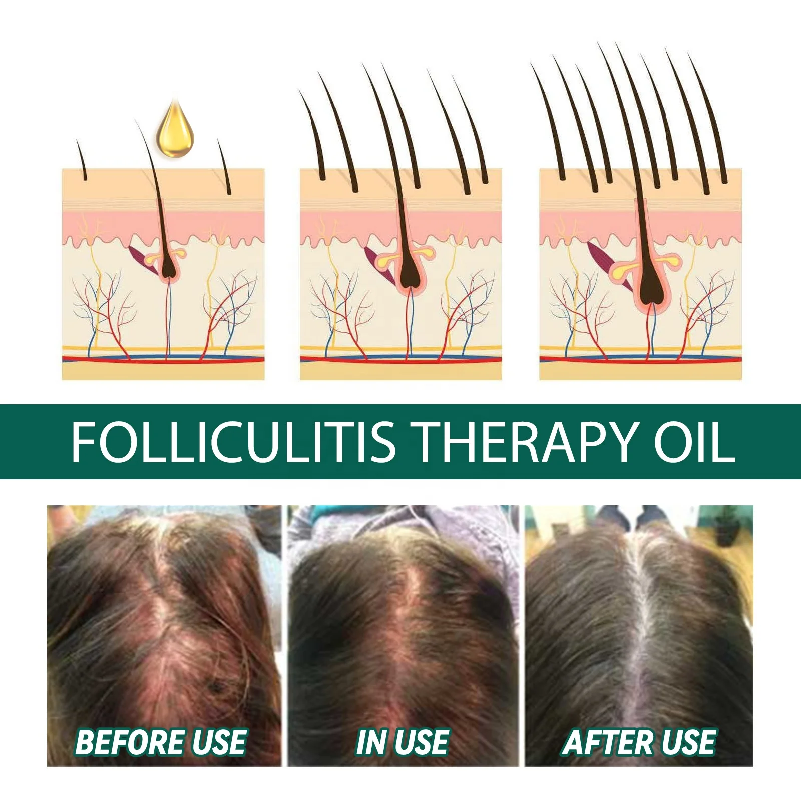 Herbal Hair Loss Treatment Restore Scalp Growth Hair products Best Hair Loss Solution Oil