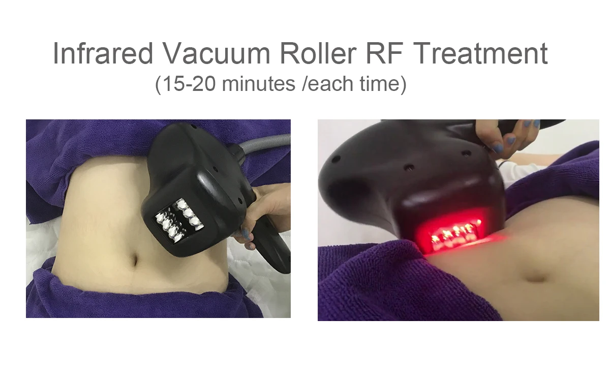 Hot Sale 2 in 1 Infrared rf 80k Body Massage Vacuum Roller Slimming machine