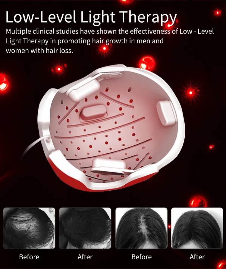 2022 Factory Wholesale Popular Helmet Hair Re-Growth Helmet Red Light Near Infrared Physical Therapy Hat Germinal Hair Care