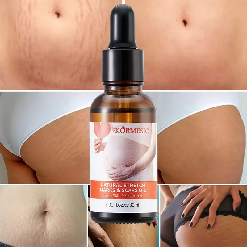 OEM ODM private label KORMESIC Stretch Marks Removal Oil Skin Firming Removes Scar Postpartum Stretch Mark Oil