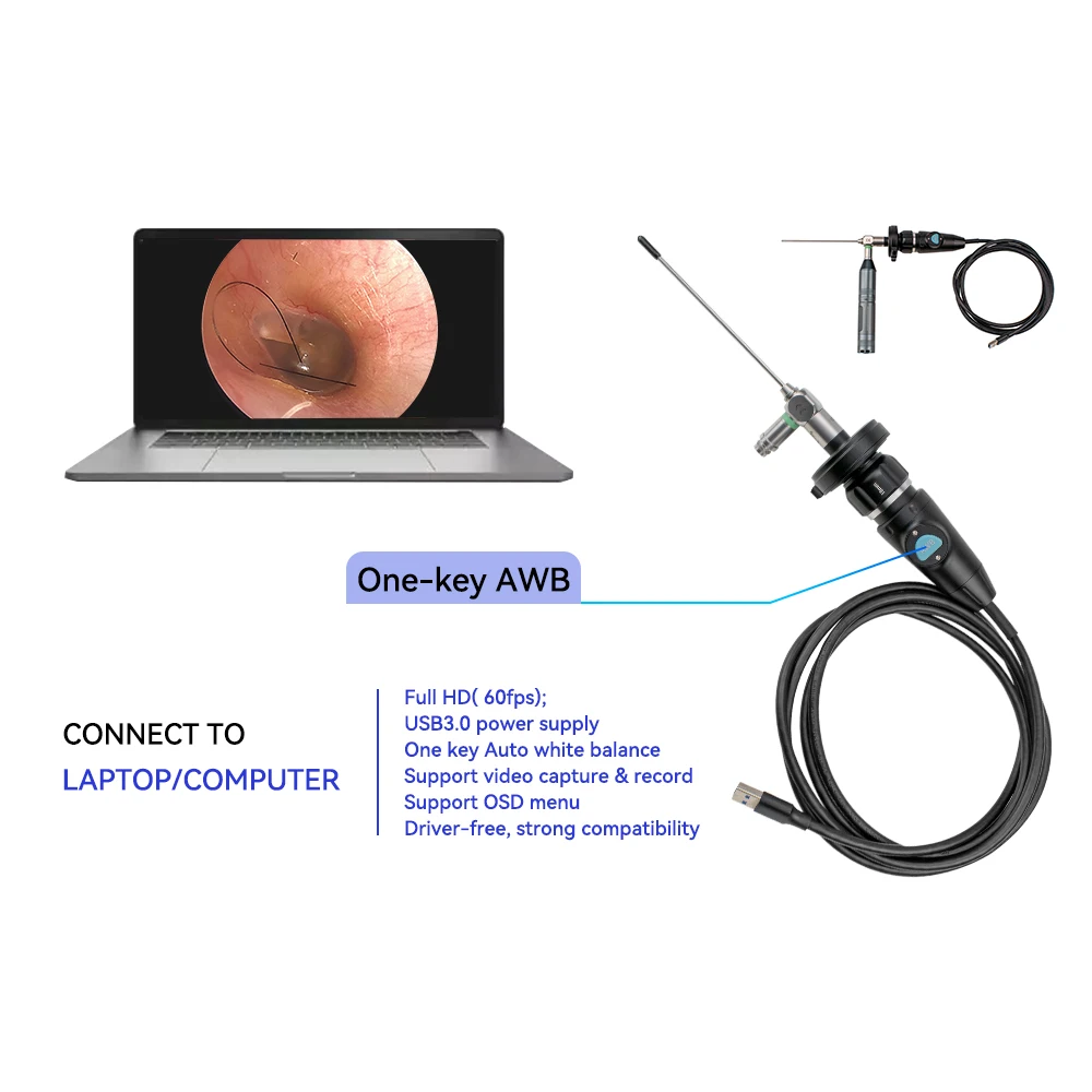 Medical New type HD portable mini ent endoscope usb camera/portable ent endoscope for inspection