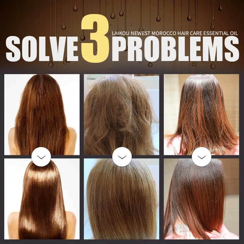Wholesale Best Hair Building Fiber Spray Natural Cure Hair Loss Product For Bald Head