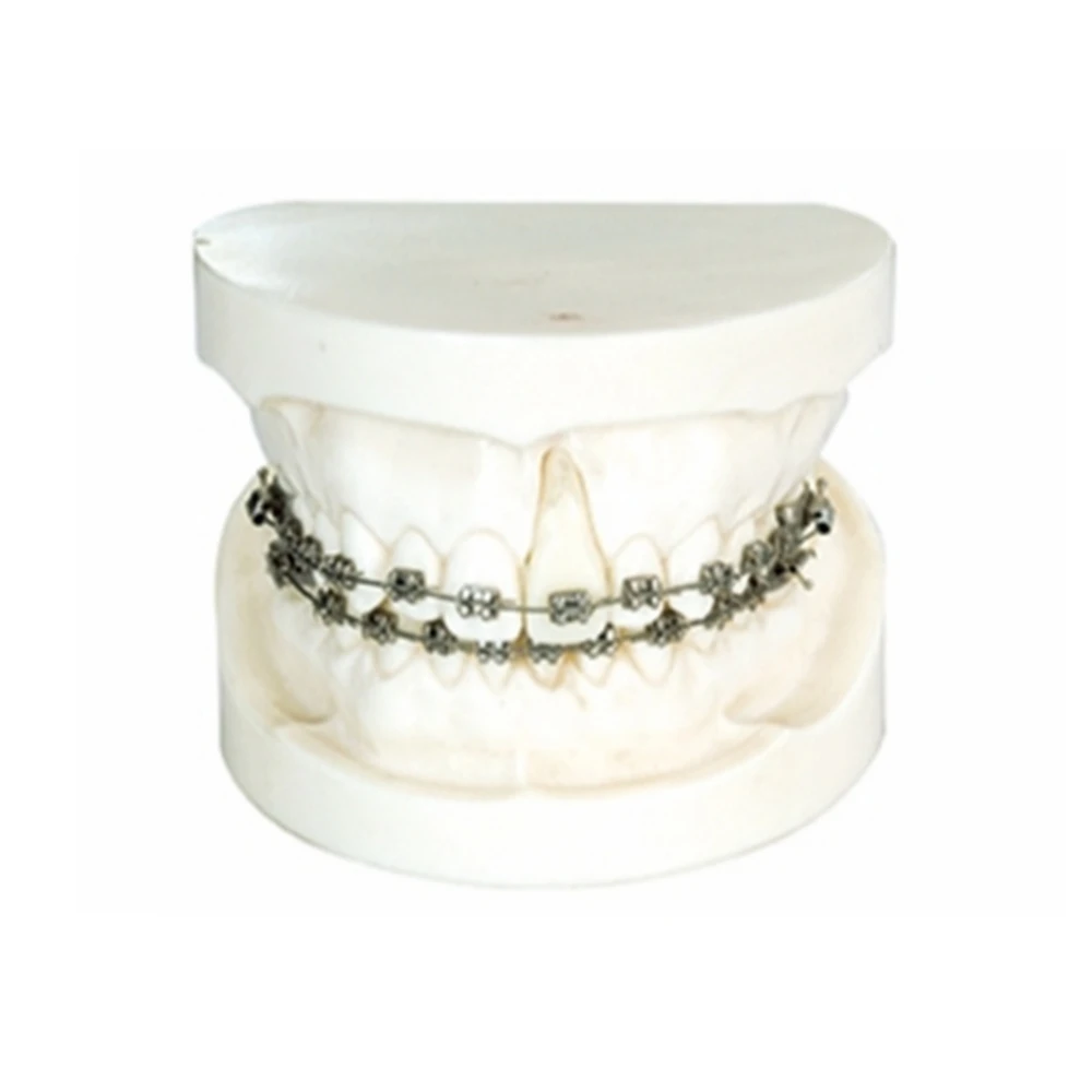 Ортодонтическая Стоматологическая модель с круговым кронштейном