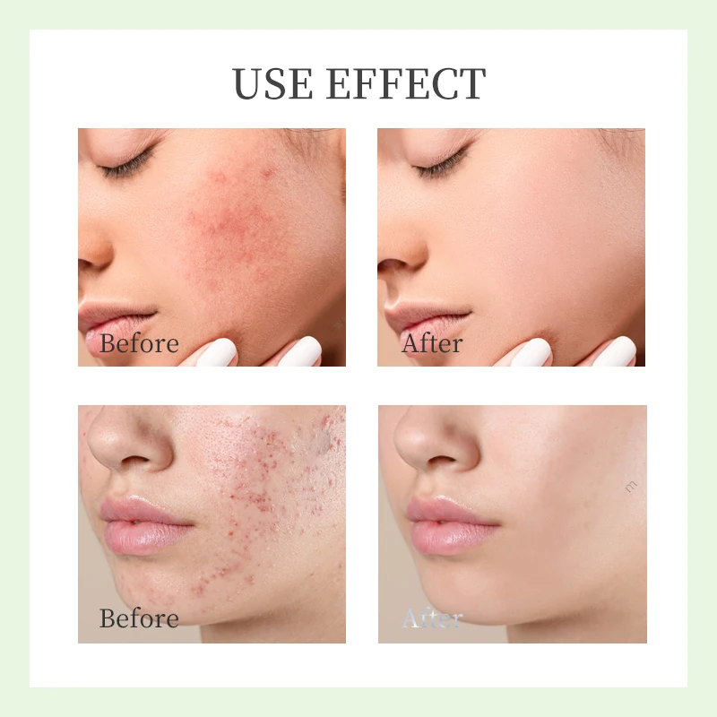 Органический набор для ухода за кожей 8-серии средства отбеливания от прыщей алоэ увлажняющий солнцезащитный крем омолаживающий унисекс уход путешествий