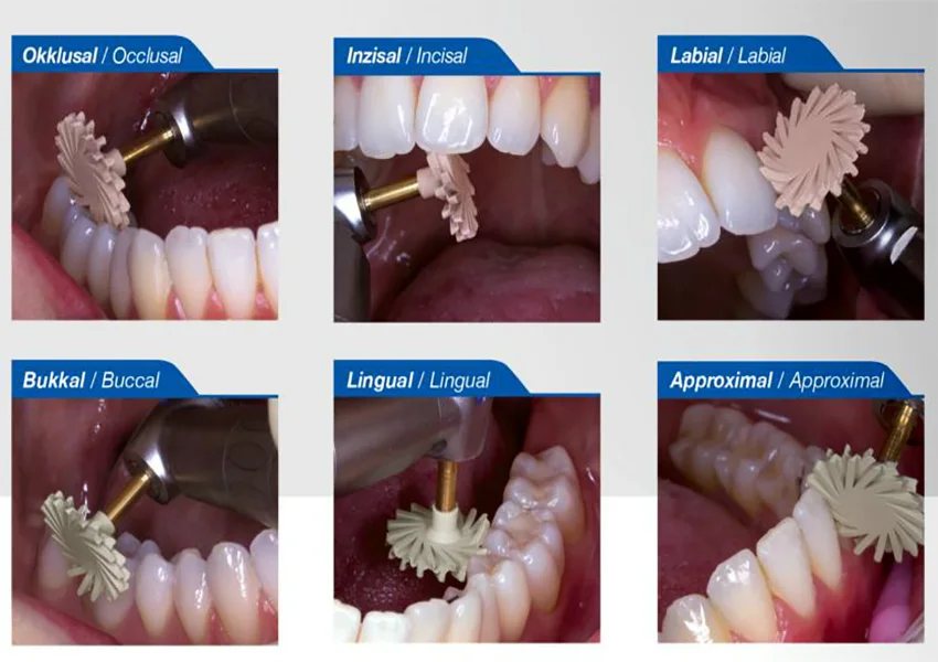 Dental Resin Silicone Resin Polishing Disc Dental Composite Polishing Kit endodontic instrument