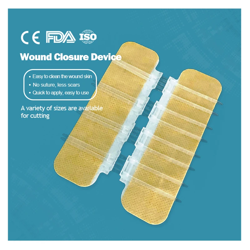 Медицинское устройство для застежки-молнии на клейкой основе