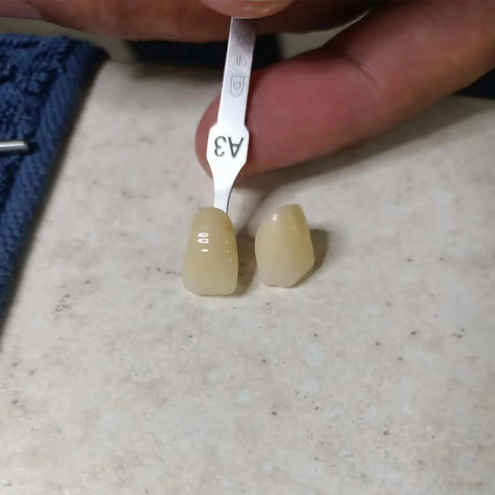 Factory Price ST-ML Zirconia Block Multilayer Dental Blanks Cad Cam System