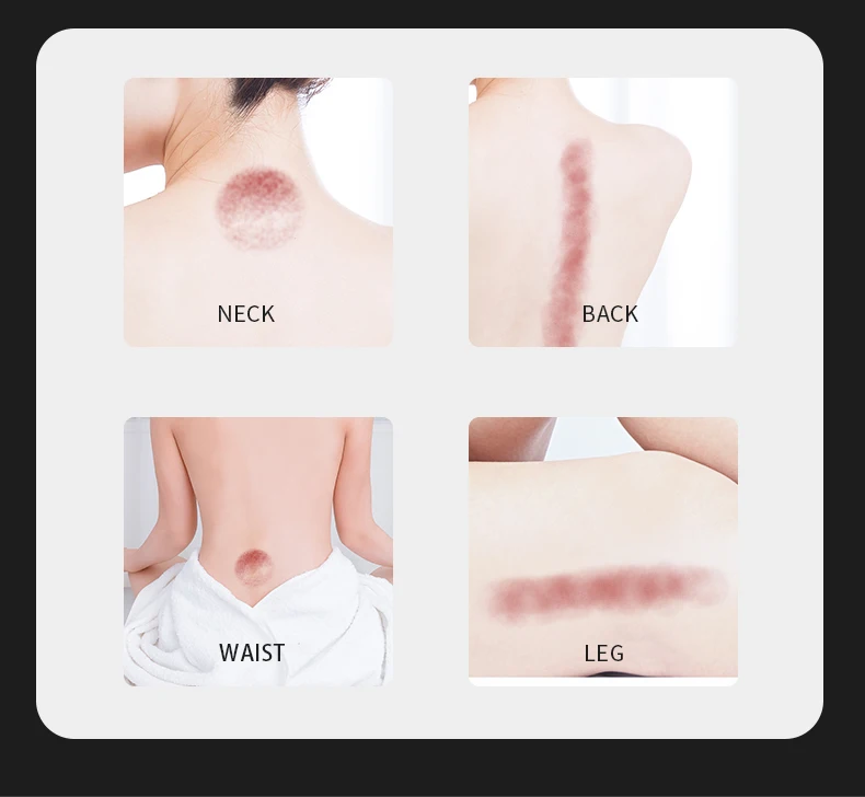Hot Sale Smart Cupping Cups Therapy Massager Device Electric Vacuum Heated Cupping