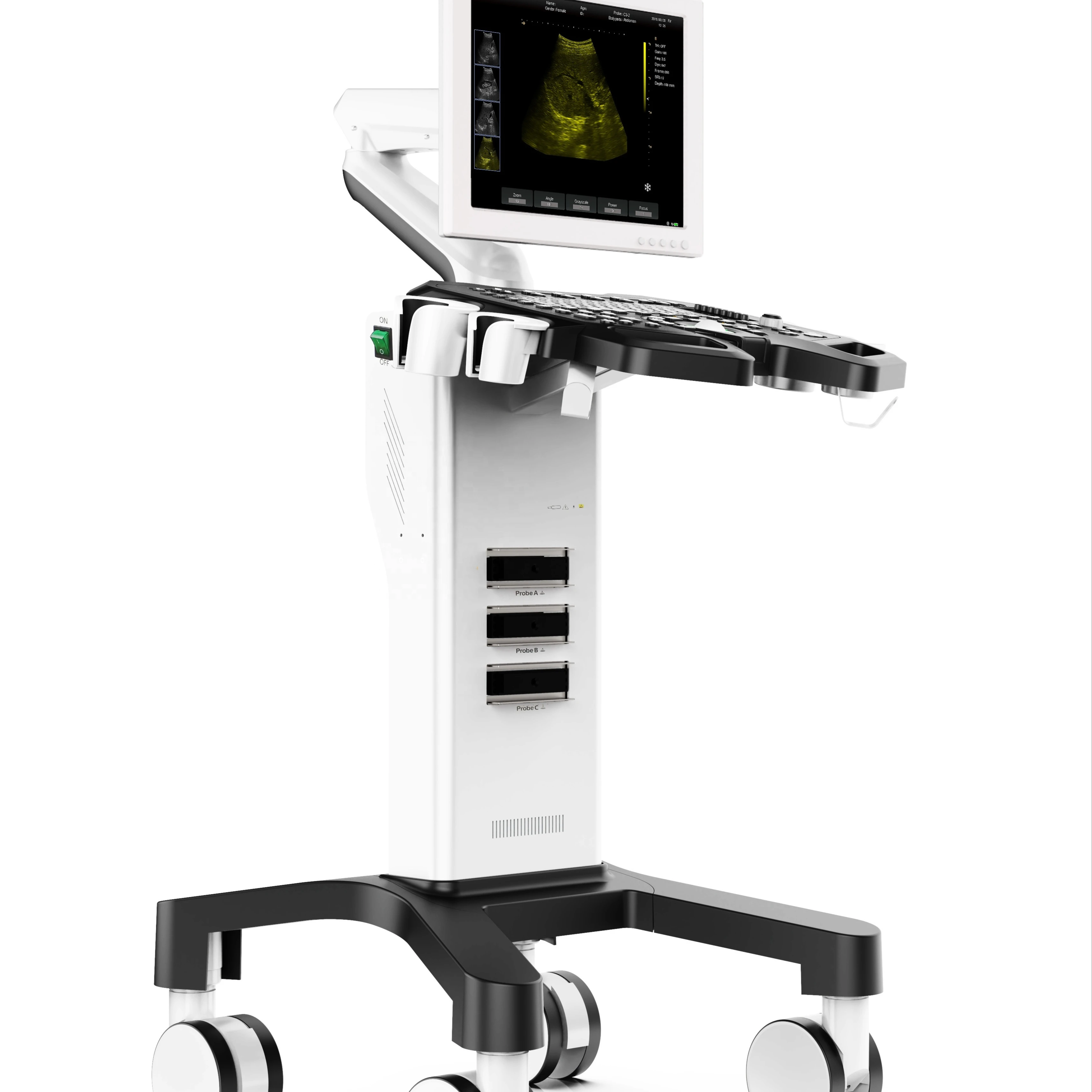 Full Digital Medical Color Doppler 3D Trolley Black and White System for Human Vet