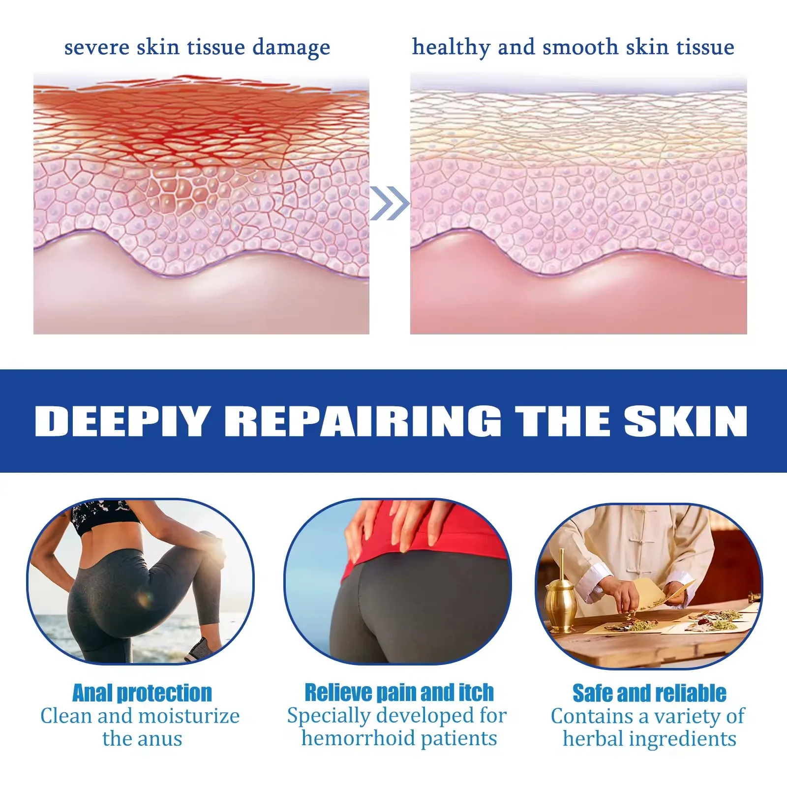 New arrival health care cream Bleeding hemorrhoids Burning pain of anus Treatment Relief Pain Hemorrhoids Ointment 20g