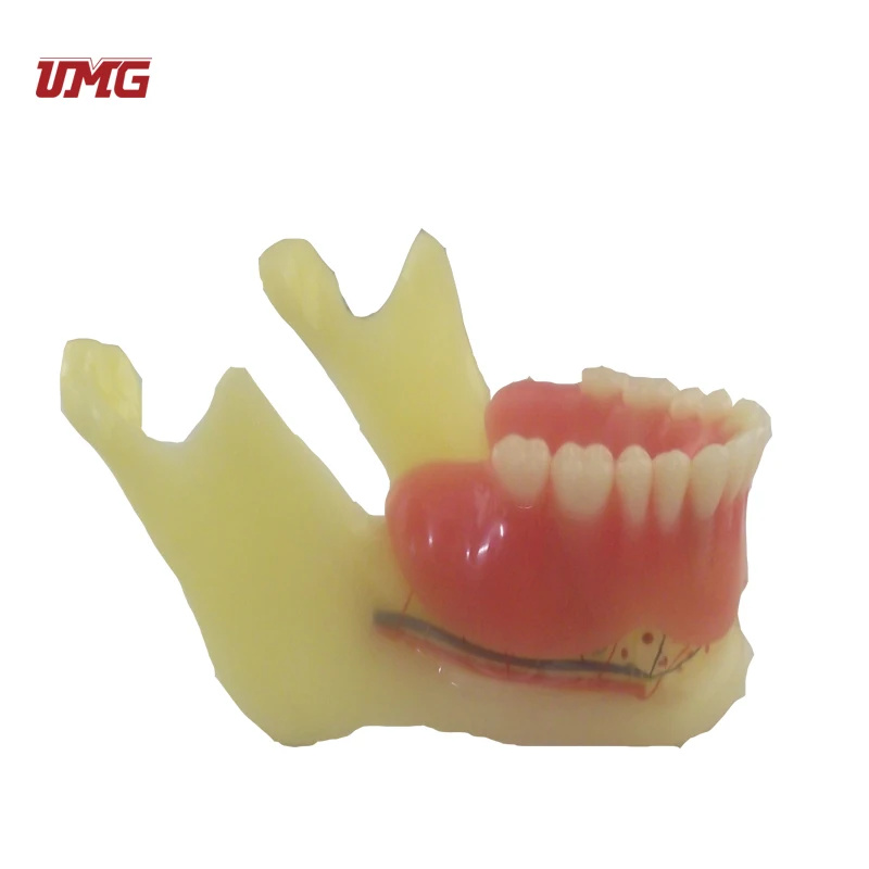 Resin Mandibular Detachable Jaw Bone Denture Model with Belt Nerve and Teeth
