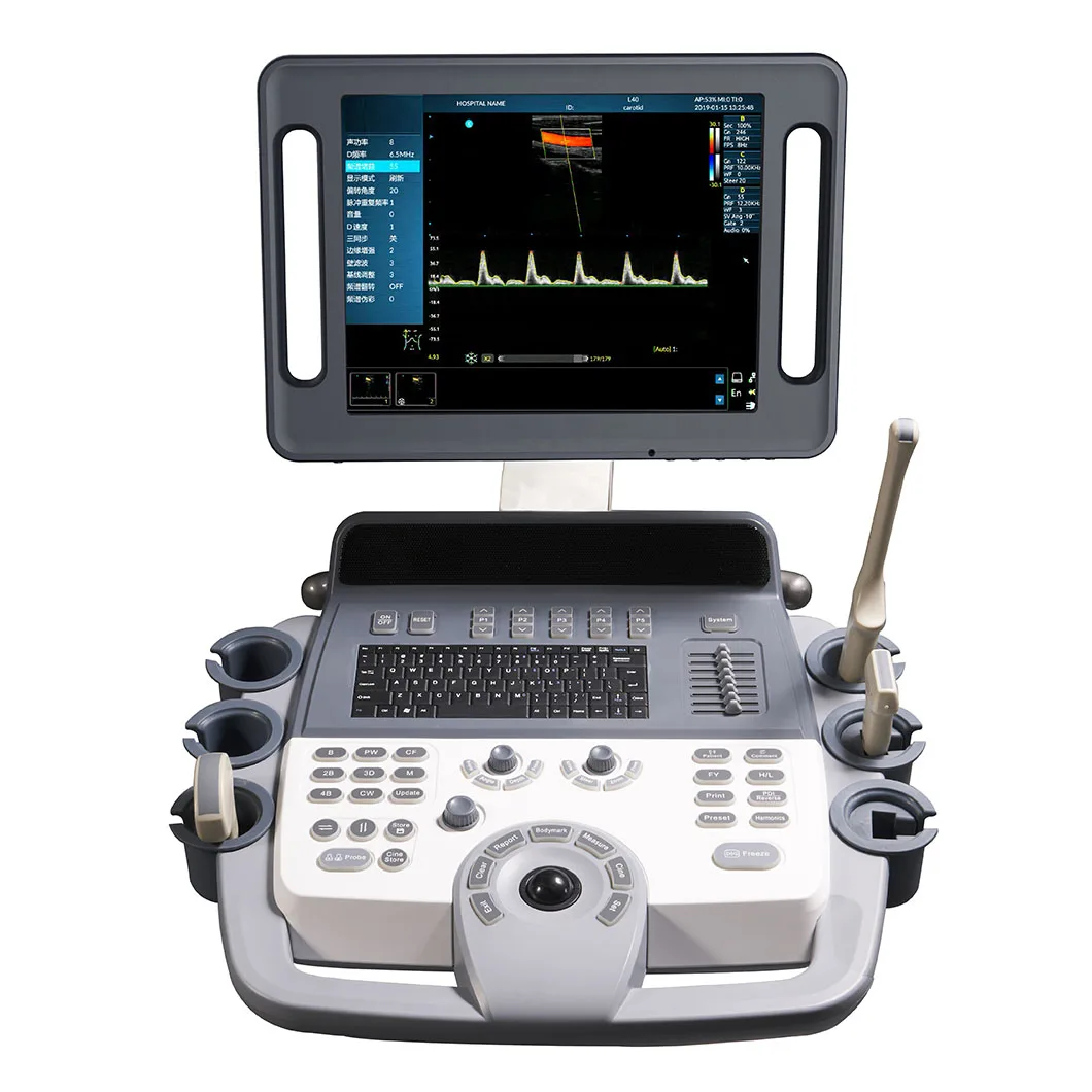 Горячая Распродажа Мобильный аппарат фибросканирования 2D PW THI тележка Цветной Допплер ультразвуковой