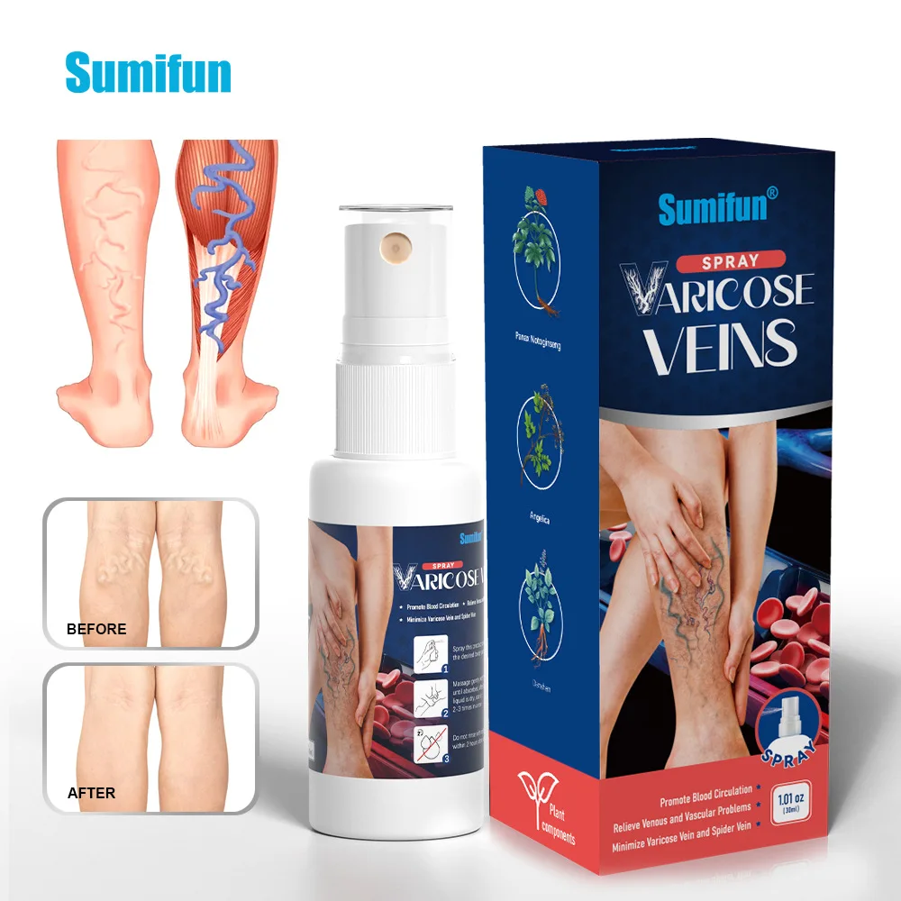 Sumifun 30ml Varicose Veins Spray Relaxing Leg Improve Blood Circulation Relief Blood Vein Spider Veins Treatment Spray