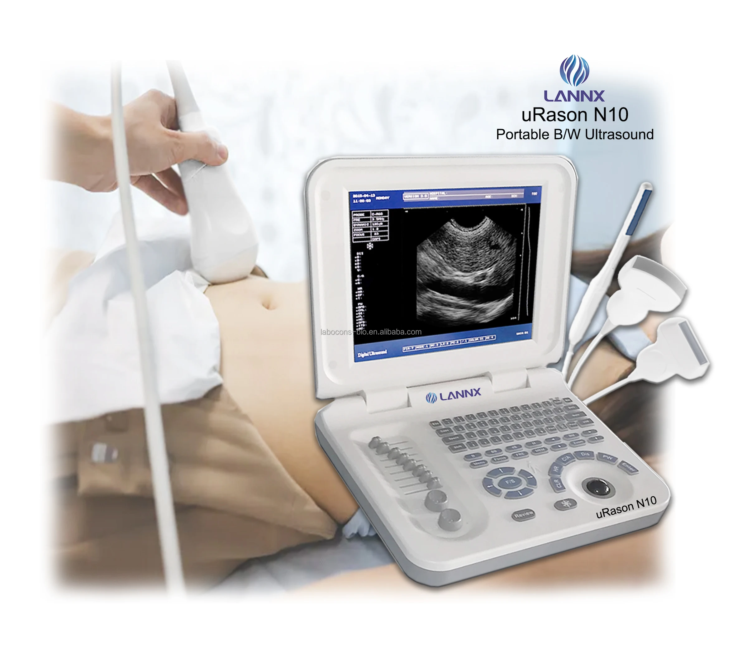 LANNX uRason N10 Original stock Black White Echocardiography can Multiprobe Medical Ultrasound Instruments Portable ultrasonido