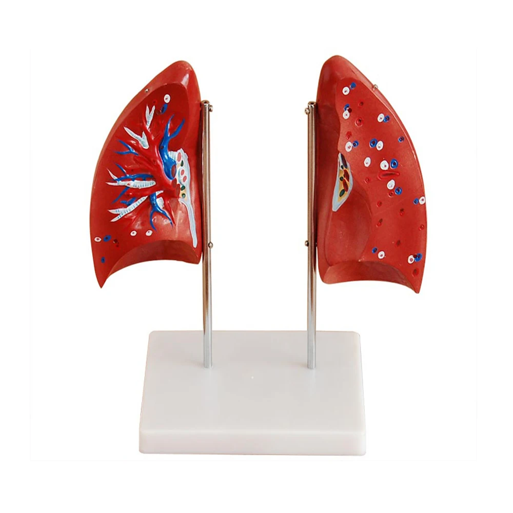 LTM321 пластиковая анатомическая модель легких для продажи