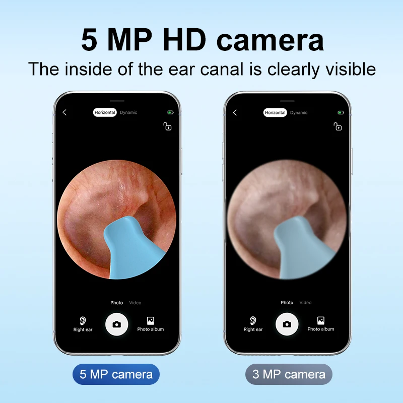 X9 5MP HD Pixels Camera Hot Sell Earwax Cleaning Otoscope Endoscope Camera for Mobile Phone