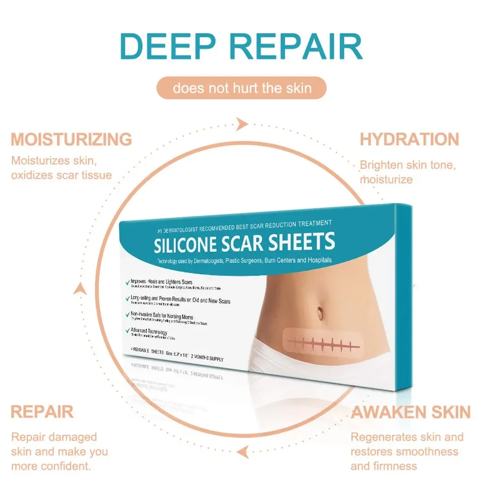 Silicone Scar Removal for Scars Caused by C-Section Surgery Burn Acne Works on Old & New Scars Reusable Sheets