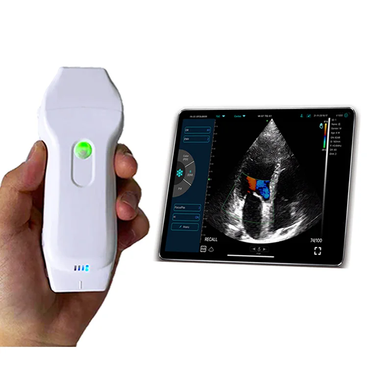 Good price Konted C10RL lightest portable  wireless&USB  3 in 1Color Doppler  ultrasound scanner