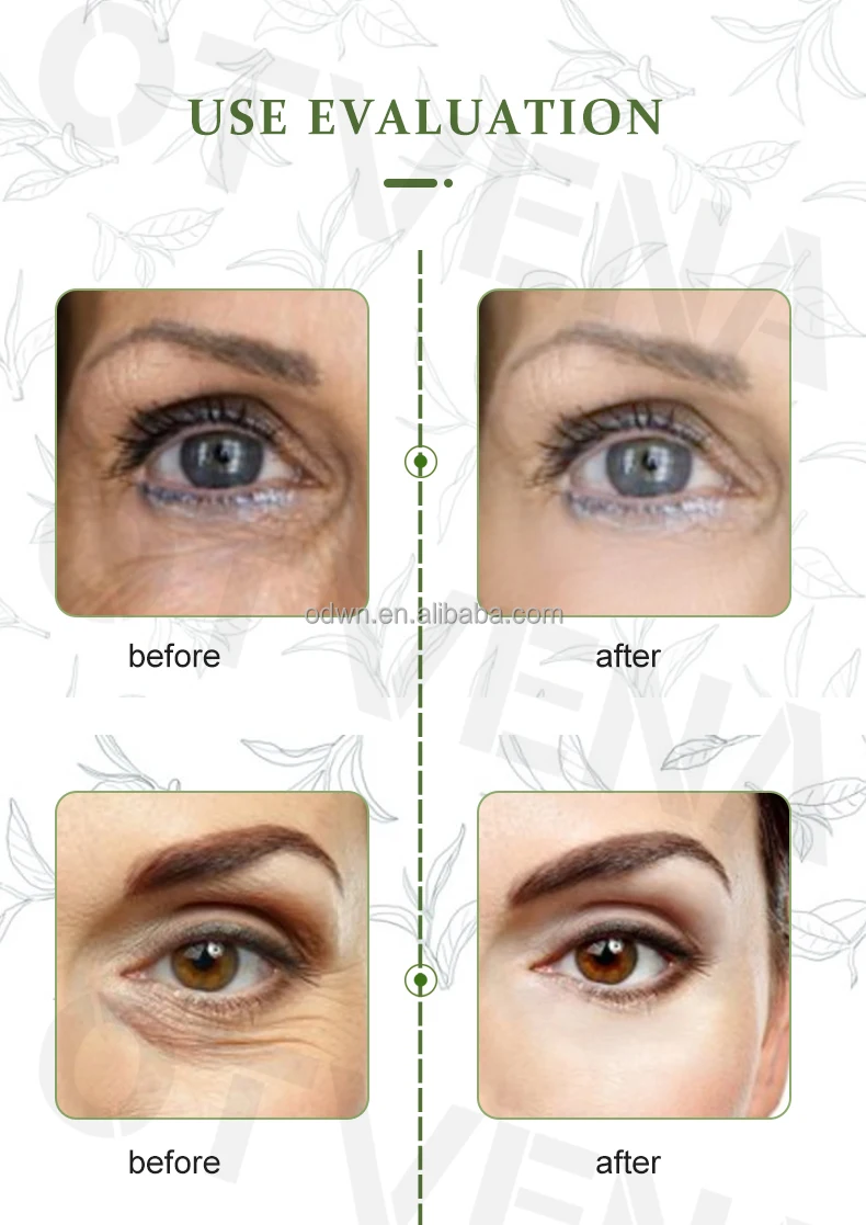 Rebrand OTVENA Anti-Wrinkle Eye Cream Rapid Skin Care Lifting Serum