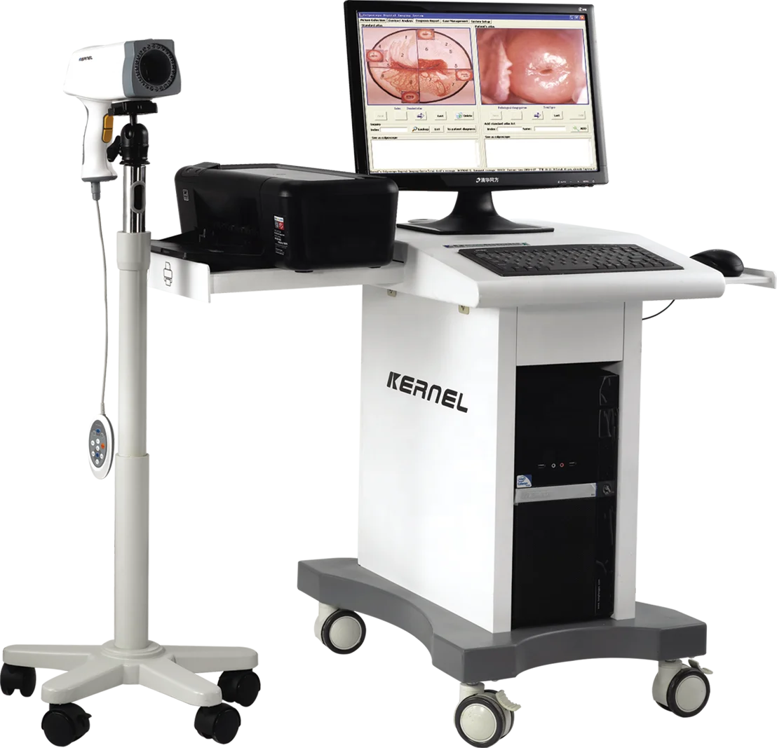 Цифровая система видеосъемки Colposcope Женская вагинальная испытательная камера Colposcopy машина