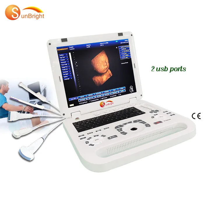Hot Sale ultrasound portable laptop SUN-800D Ultrasound Portable Ultrasound Machine