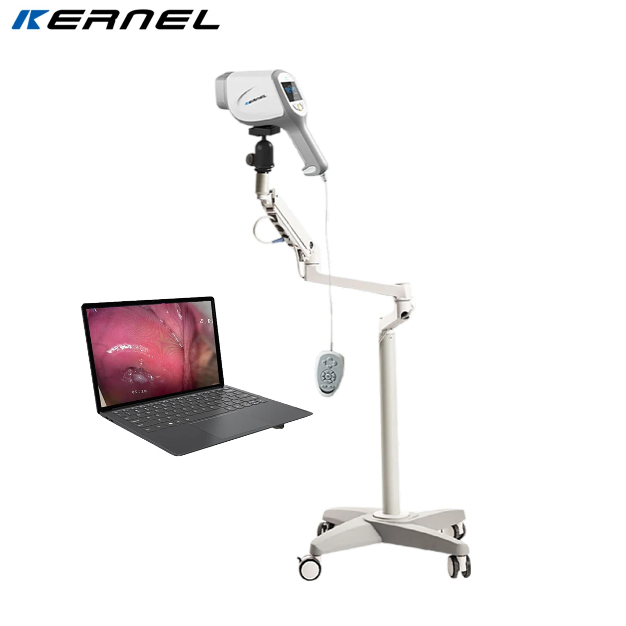 Digital Optical Colposcope for Gynecology HDMI LED Light Source Microscope Electric Power Source-Available for Sale