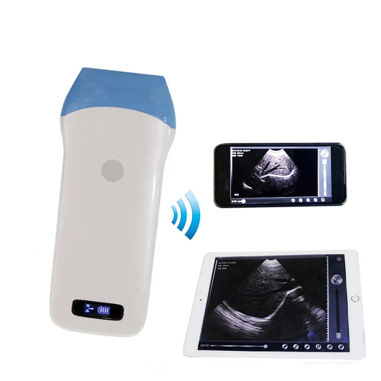 JQ-CProbe-L5 Wireless ultrasound probe linear probe color Doppler with CE