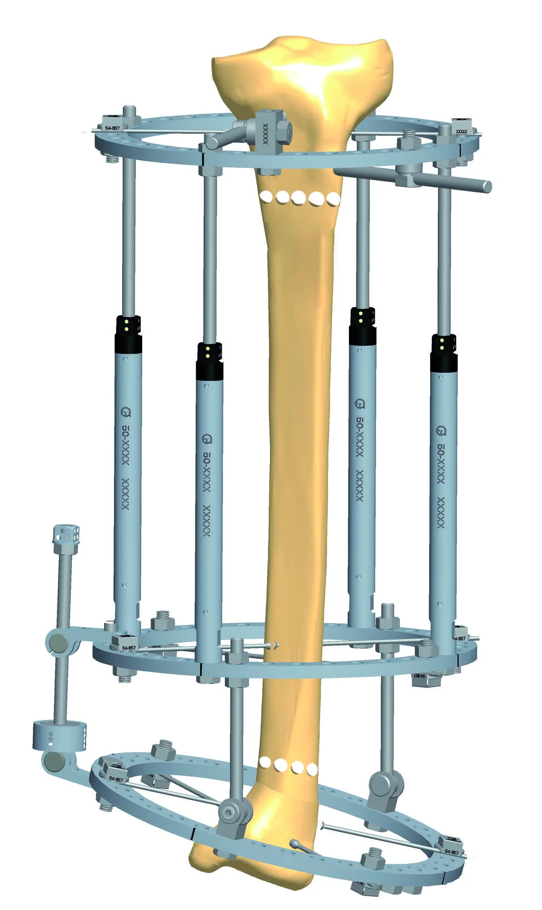 
Hot Sale Black Stainless Steel Elbow Joint External Fixator 