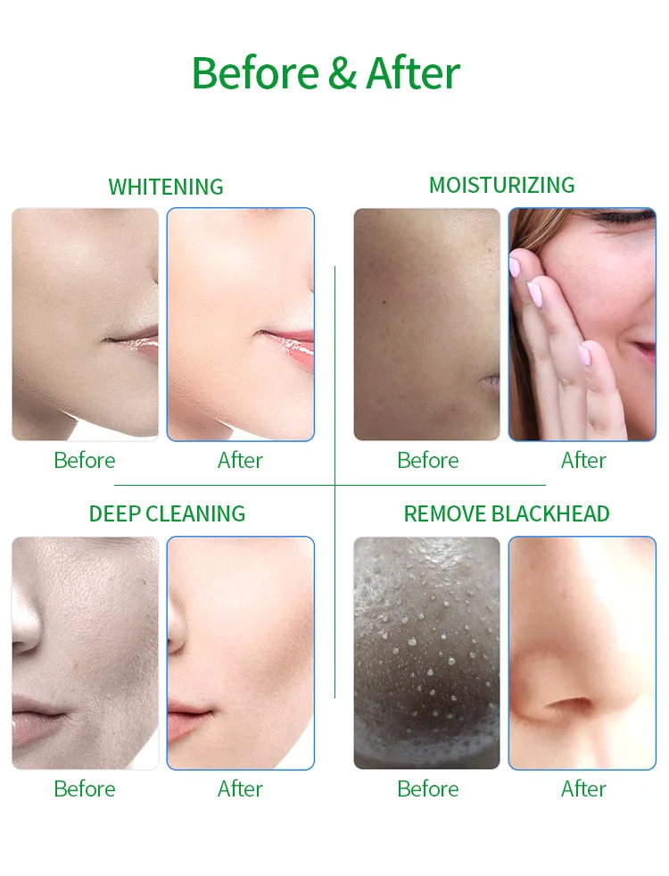 Hot Sale 6 In 1 Korea Aqua Peeling Machine Hydra Oxyge Facial Diamond Dermabrasion Machine h2o2 Hydrafacials Machine